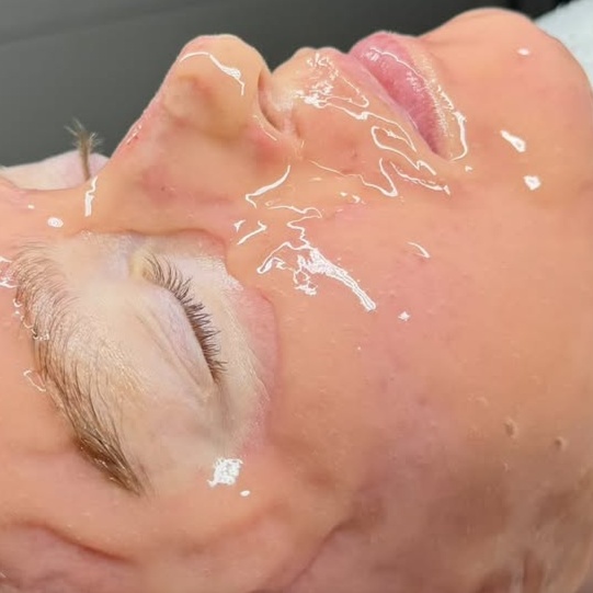 Carboxy Lift & Glow at HP Skin Bar in Durham, NC