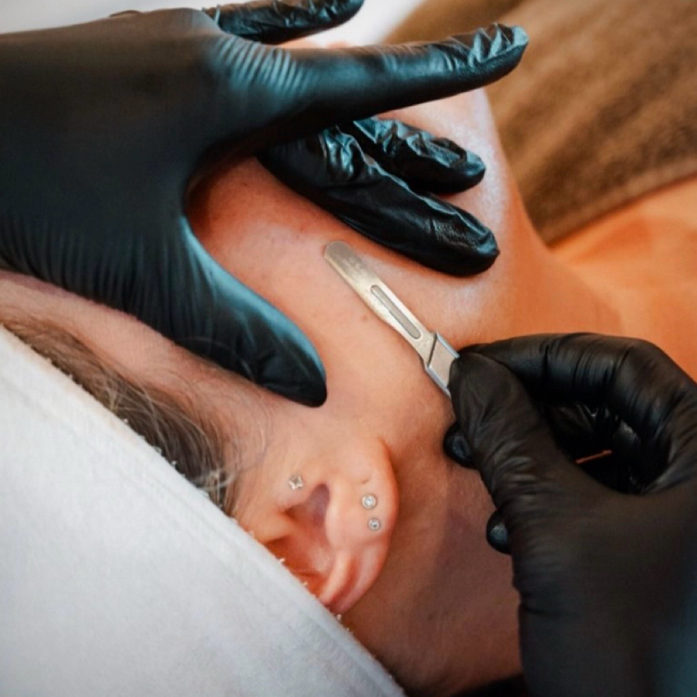 Dermaplane Express Facial at Jemm Esthetics in Moreno Valley, CA