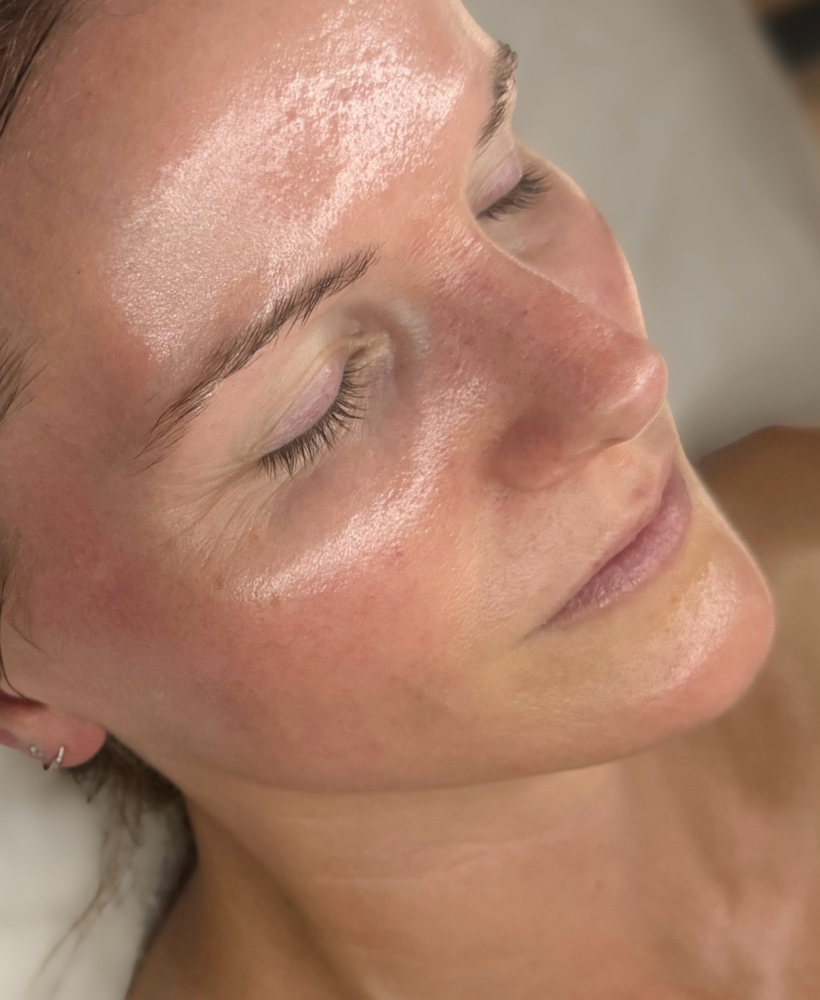 TIER IV — The Transformative Facial