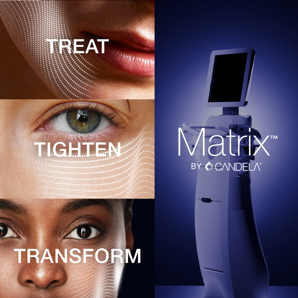 Matrix Sublime Skin Tightening at Maven Luxe MedSpa in Houston, TX