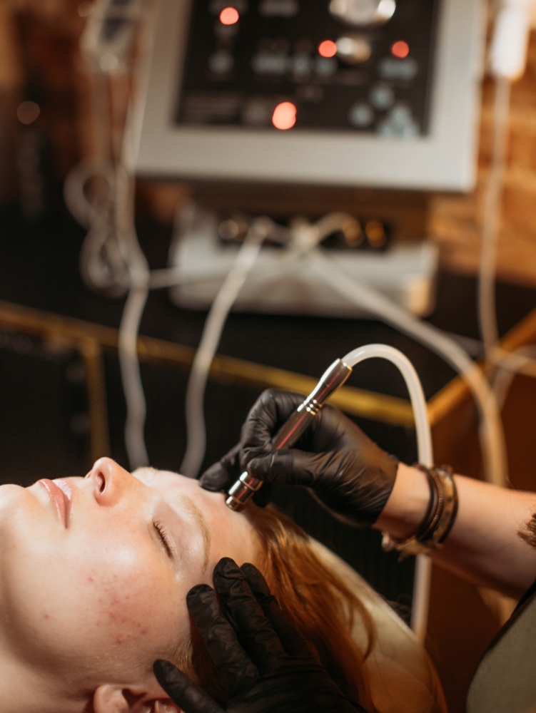 Microdermabrasion