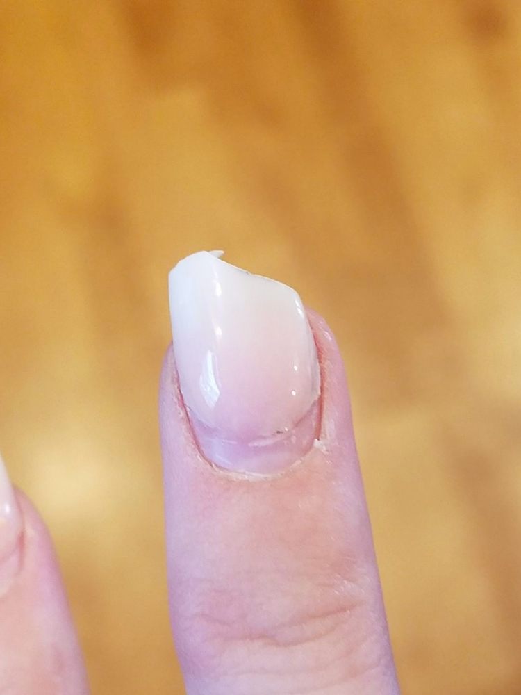 Nail Repair
