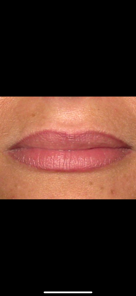 Lip Blush Removal