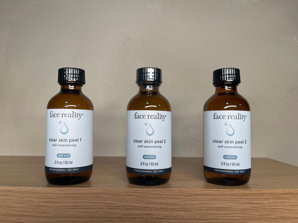 Acne Treatment current Client Only