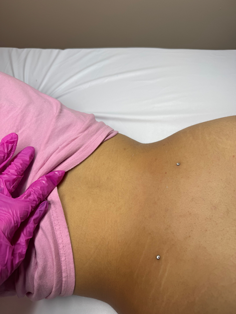 Back Wax at KayLuxAesthetics in Fuquay-Varina, NC