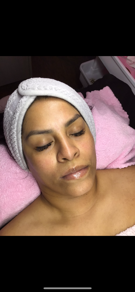 Dermaplaning Facial