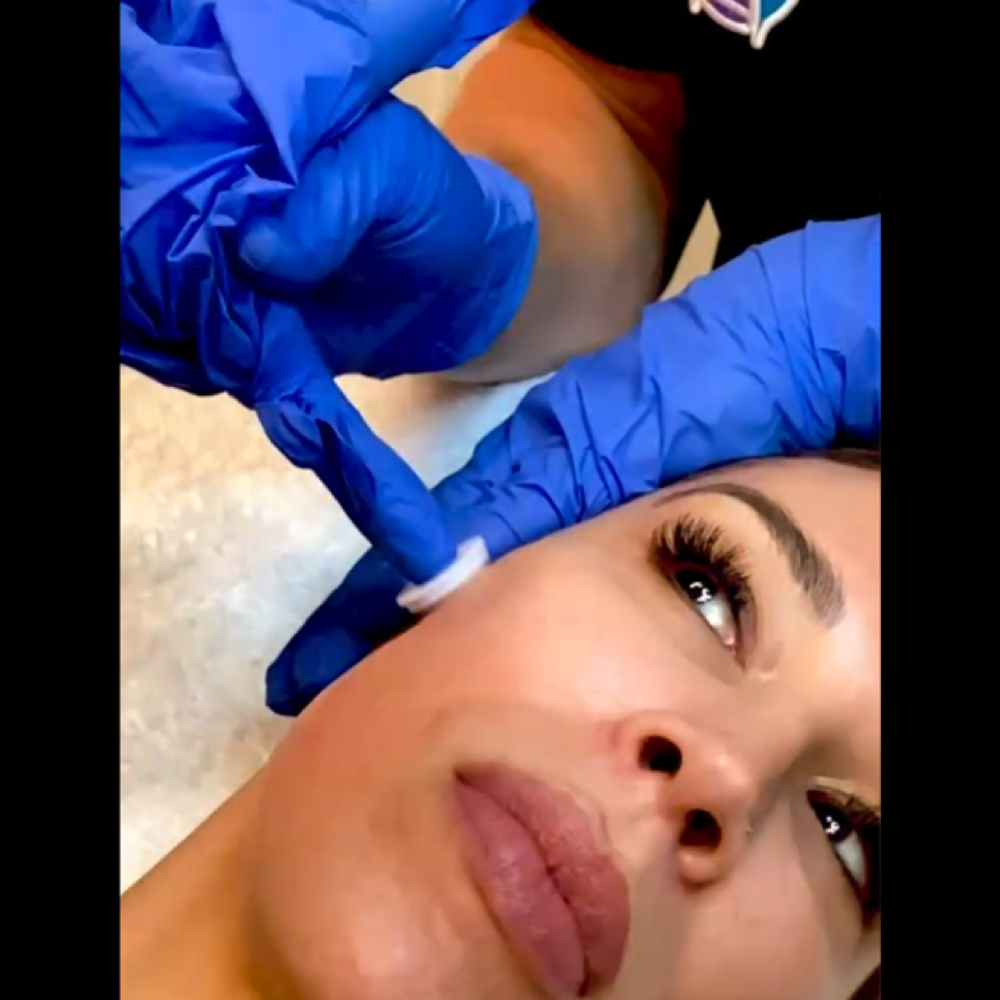 Micro Channeling at Millennium Day Spa in Inglewood, CA