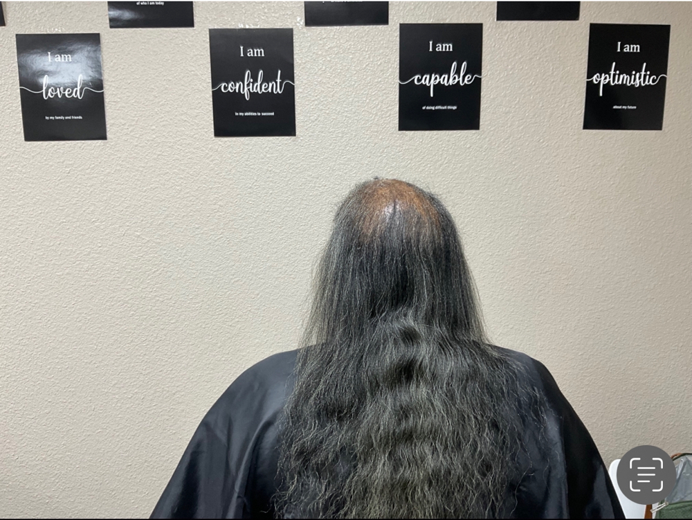 Hair Replacement Consultation