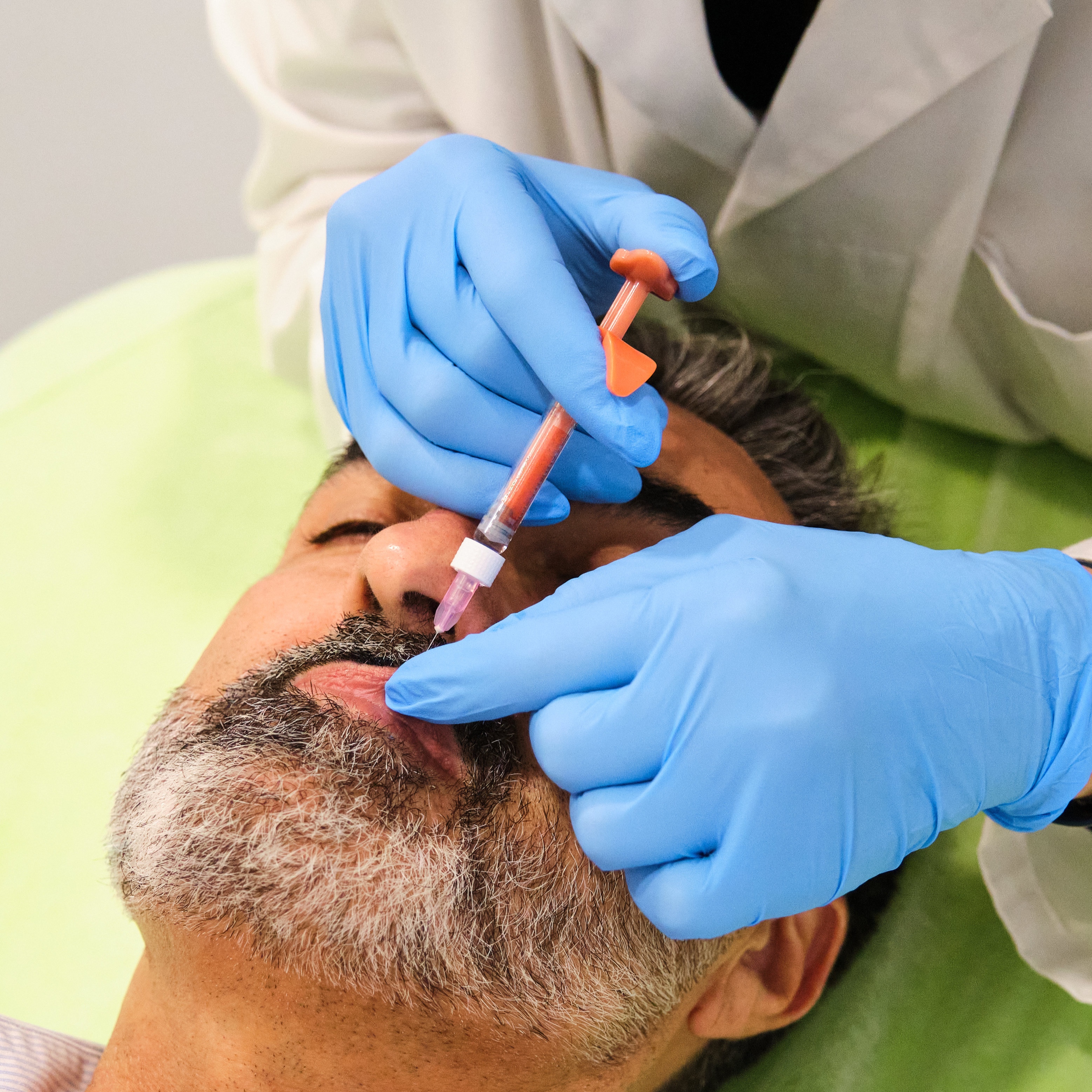 Lip Flip at 360 Med Spa Buford in Buford, GA