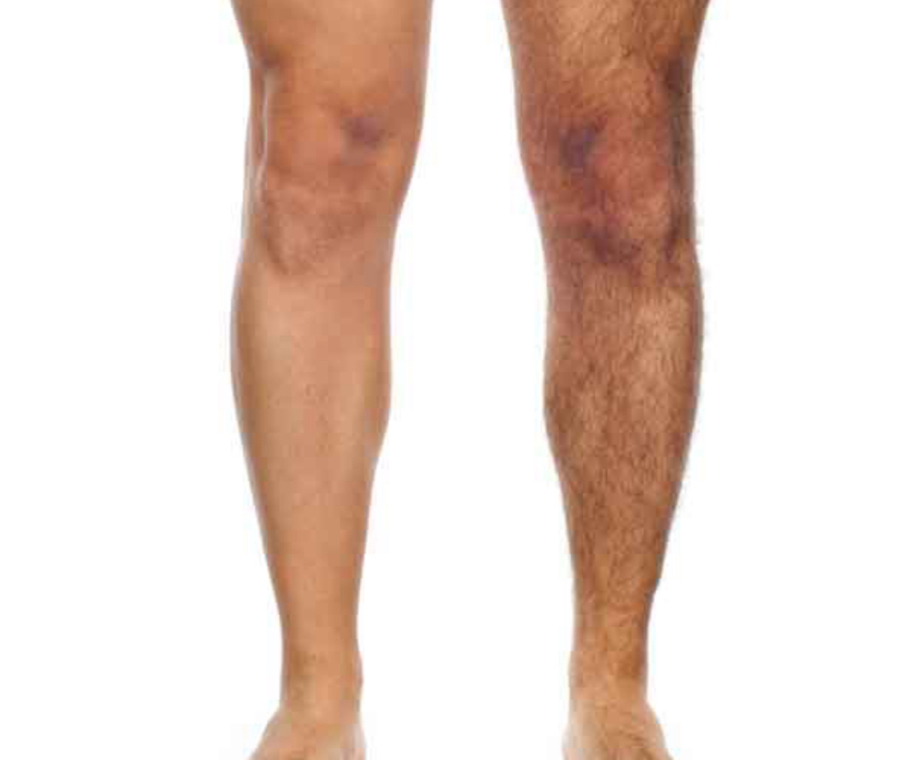 Full Leg