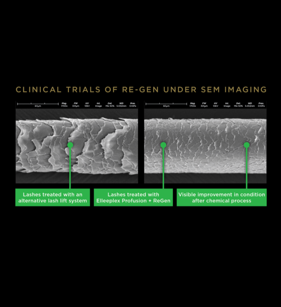 Lash Removal & Restore at Eden Esthetics in Dallas, TX