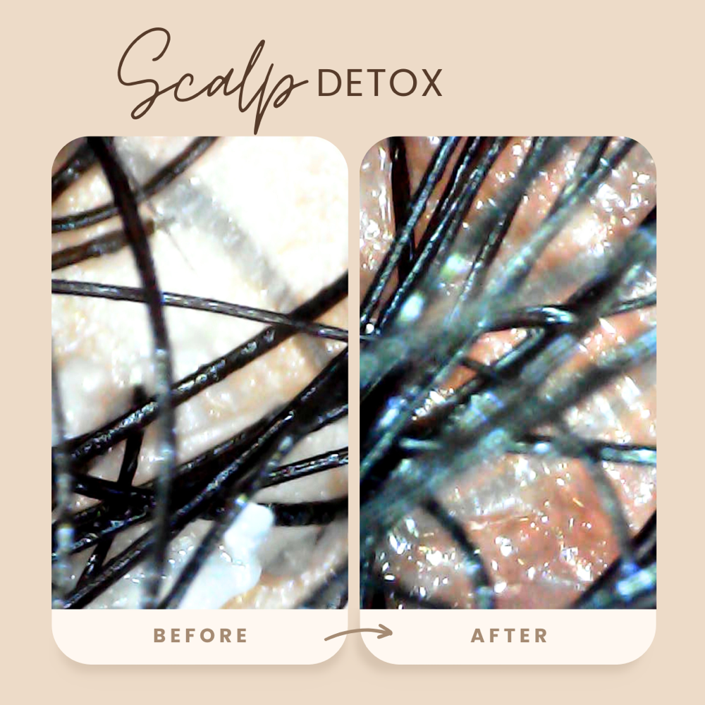 Scalp Detox Treatment