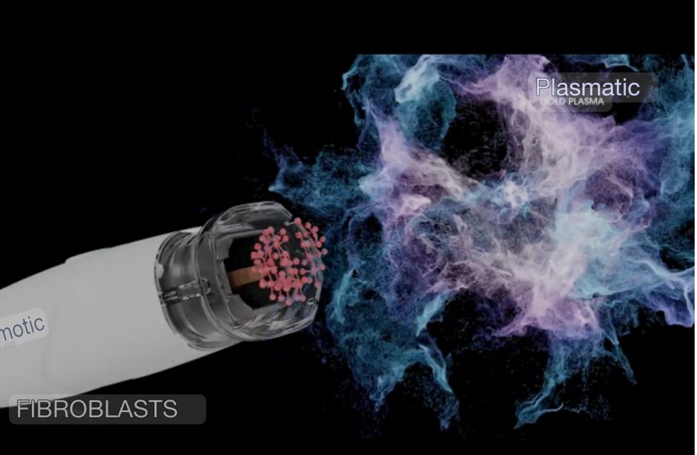 Cold Plasma Therapy Face