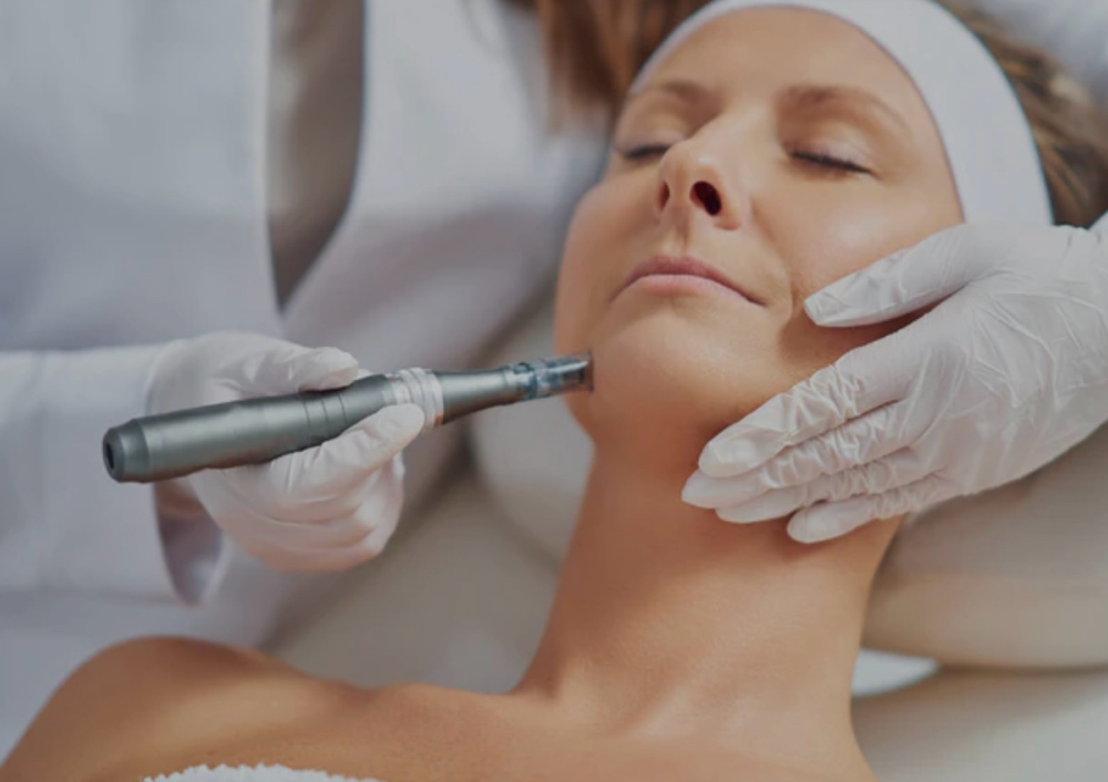 Facial Con Microagujas
