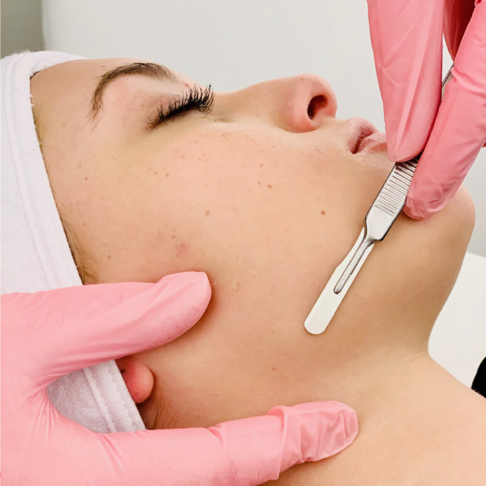 Dermaplaning at GIVE SKIN CARE in Estero, FL