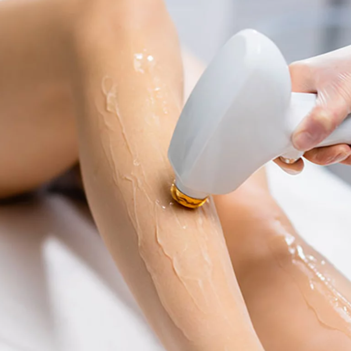 Member Laser Hair Removal Full Body at Epicentr in New York, NY