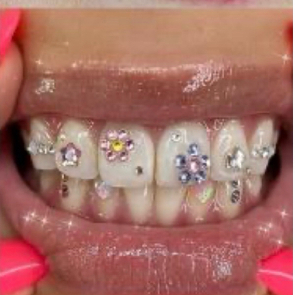 Seasonal Sparkle Packages at Allure Teeth Whitening in Greensboro, NC