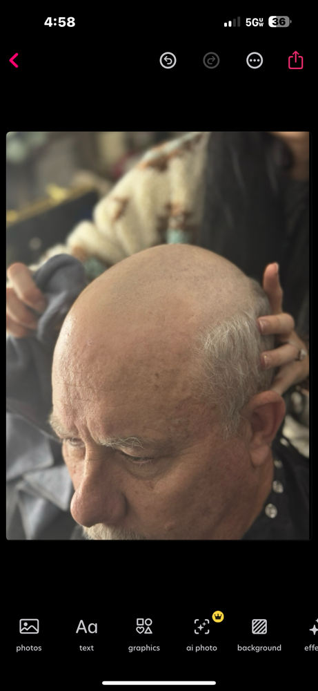 NSG Hair Replacment Consultation