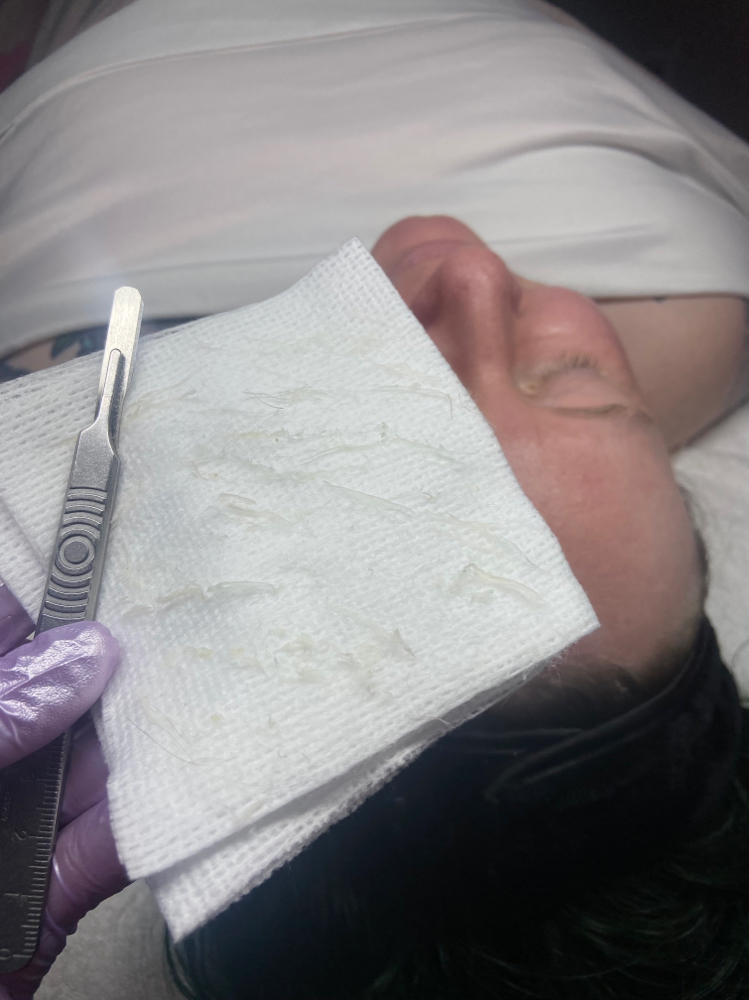 Dermaplane Facial