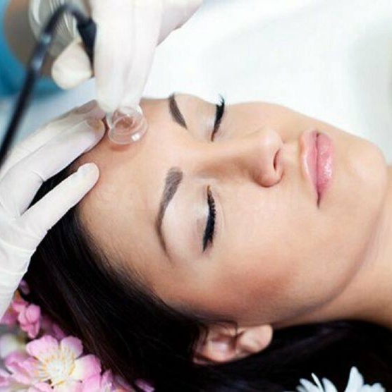 Vacuum Lifting Add-On