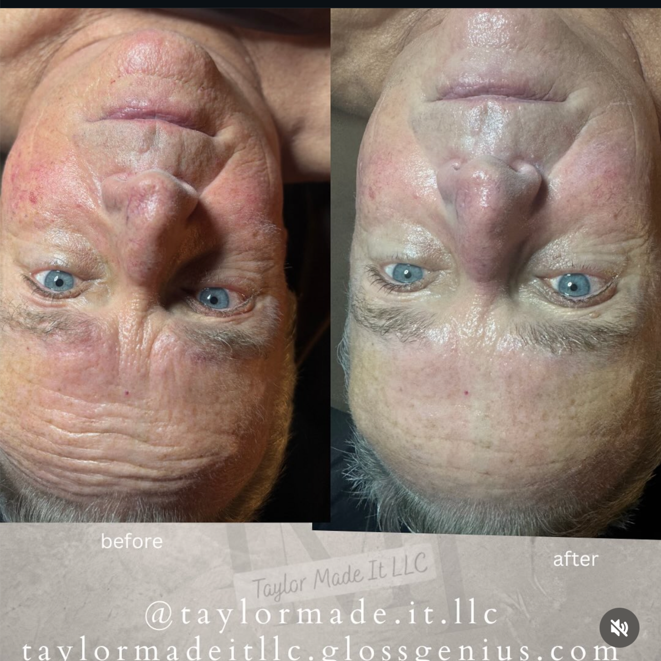 Taylor'd Corrective Facial™