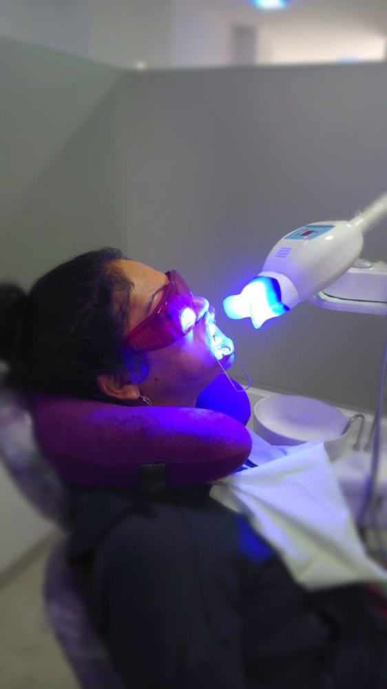 Teeth whitening