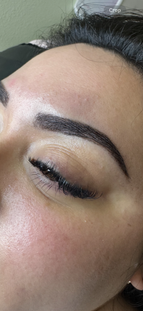 Brow Enhancements