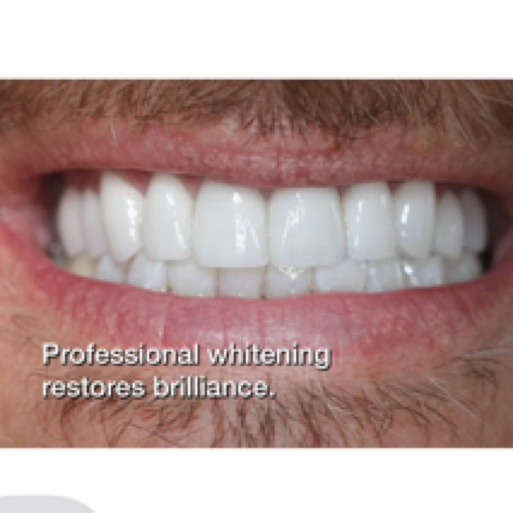 Teeth Whitening (45 Min) at Southern Sparkle Medical Aesthetics in Swainsboro, GA