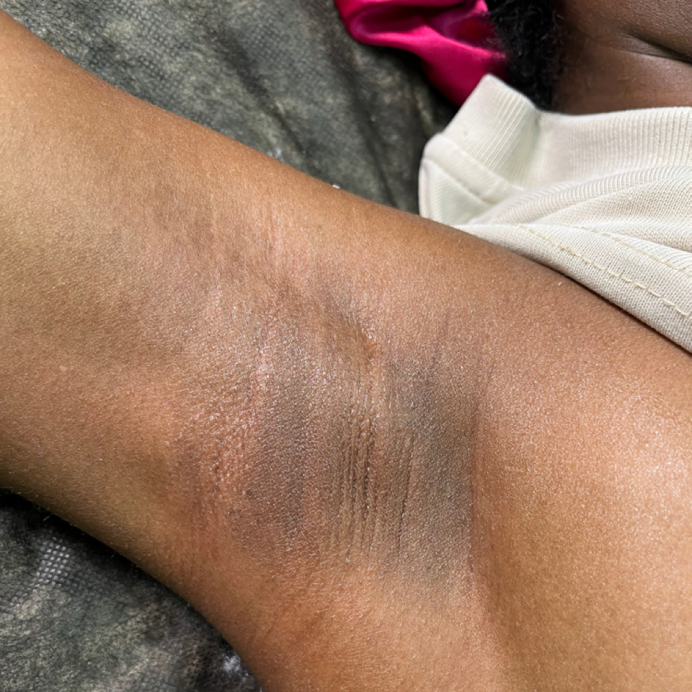 Underarm Wax at The Brown Skin Co. in New Haven, CT