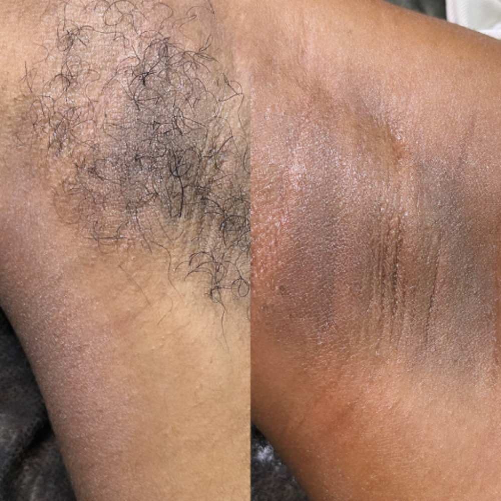 Underarm Wax at The Brown Skin Co. in New Haven, CT