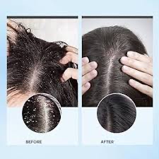 Detoxing The Scalp (dry Scalp) at Bombshell Beauty Bar @Evince salon in Vancouver, WA