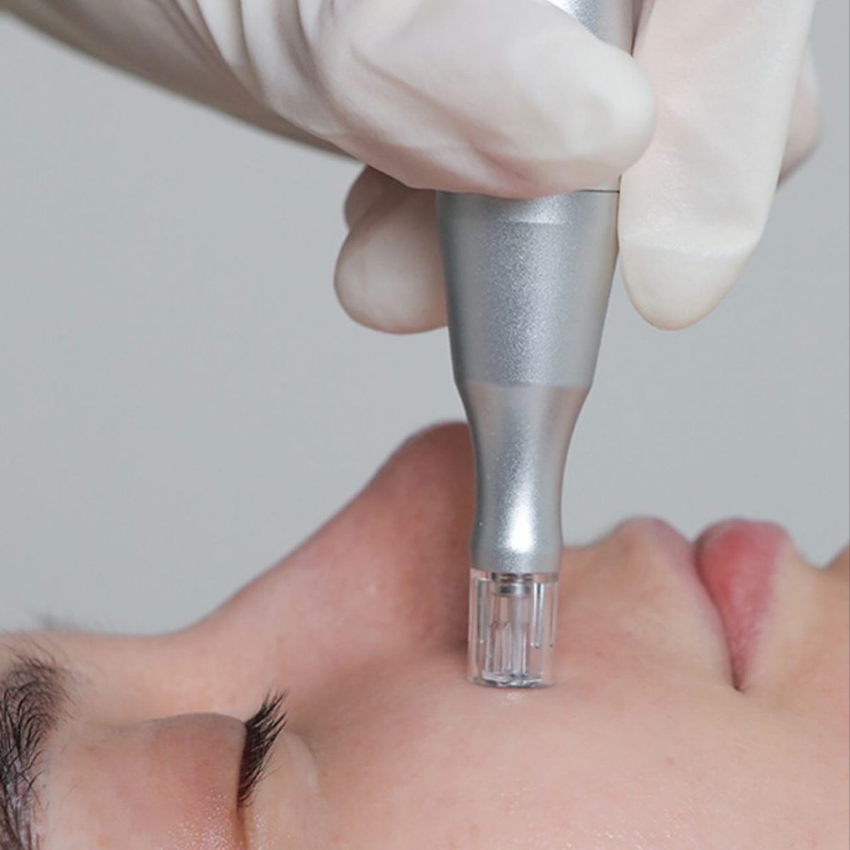 nano-infusion Upgrade at Shell Esthetics in Wilmington, NC