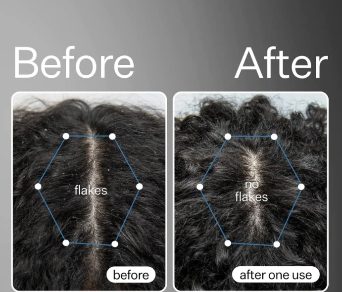 Scalp Detox/ Deep Cleaning