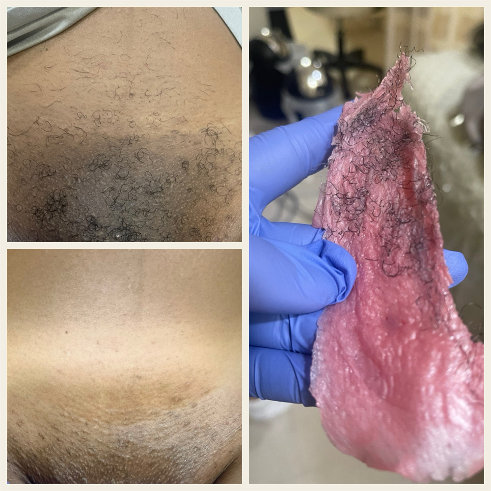 Brazilian Wax at Crowned In Glory Spa in Burton, MI