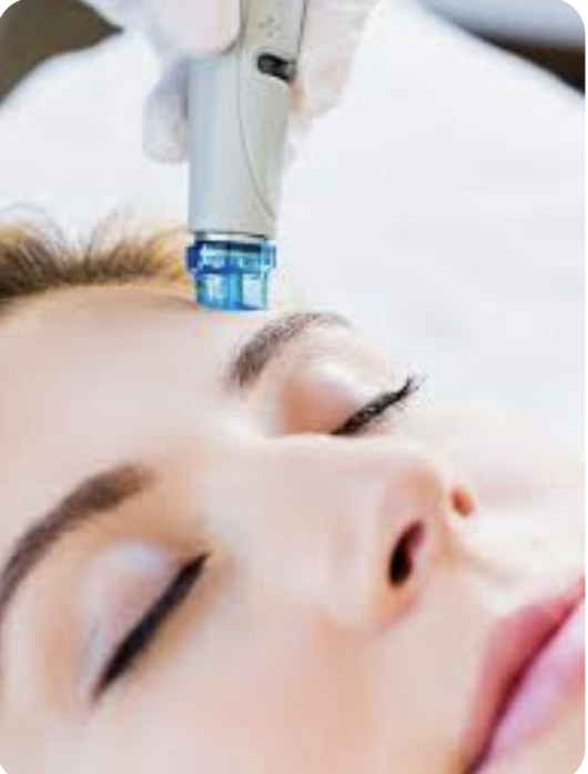 Hydra Dermabrasion (Hydrafacial)