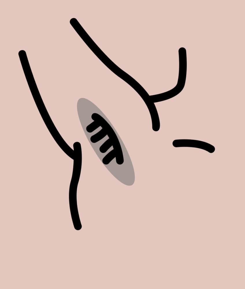 Underarm Treatment