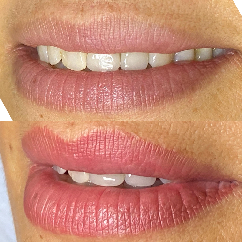New Clients Lip Blush