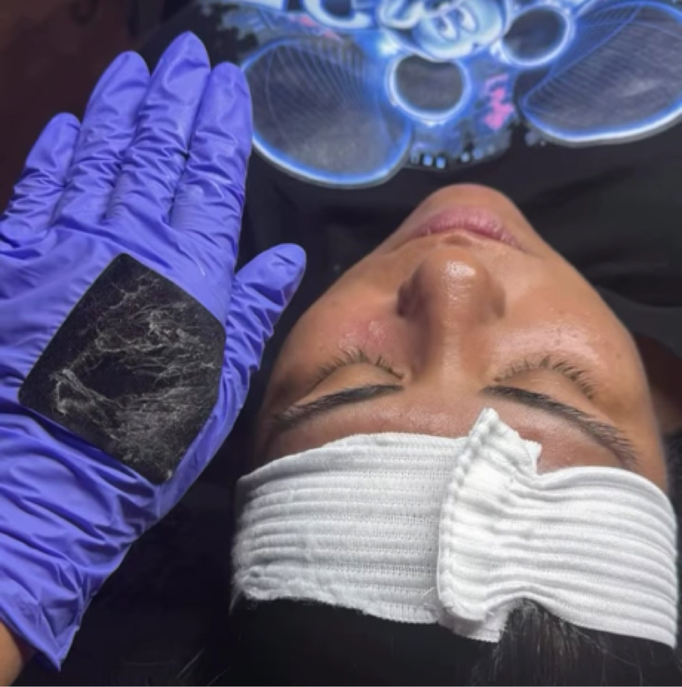 Express Dermaplane at CWC Studio in Myrtle Beach, SC