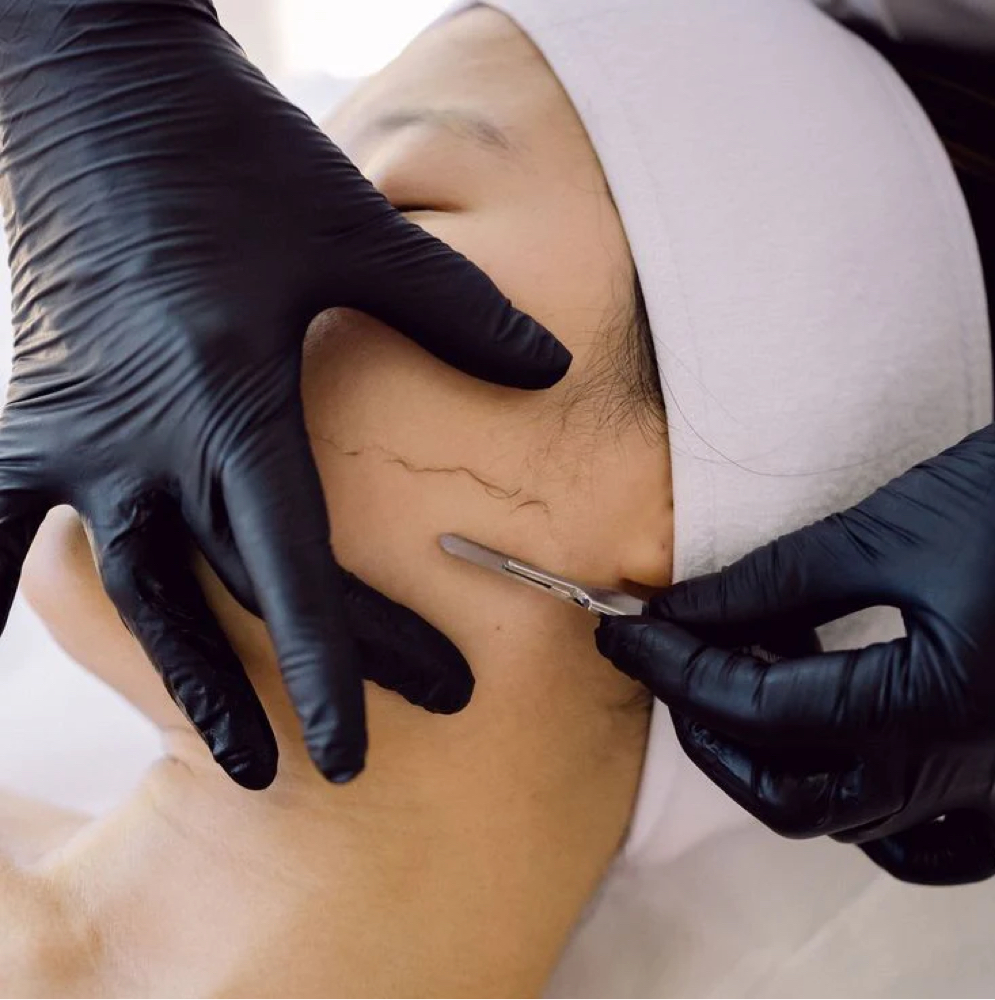 Express Dermaplane at CWC Studio in Myrtle Beach, SC