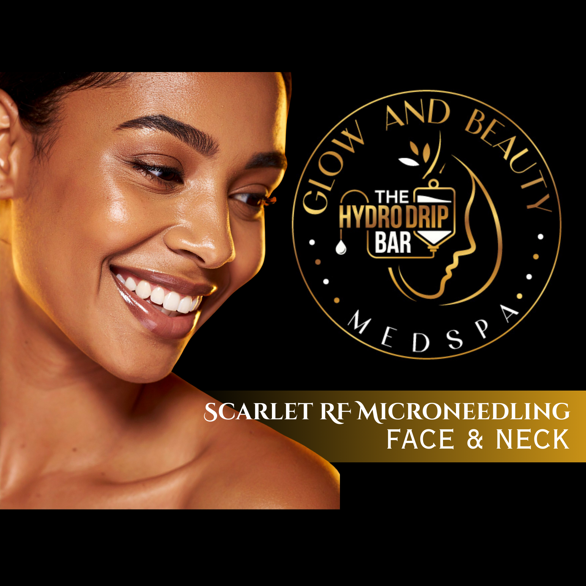 Scarlet RF -Face And Neck