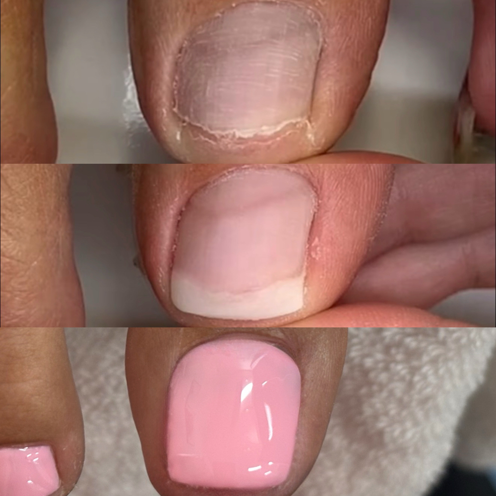 NanoFlex Pedicure (Healthy Nails) at Beauty & Essence in Moreno Valley, CA