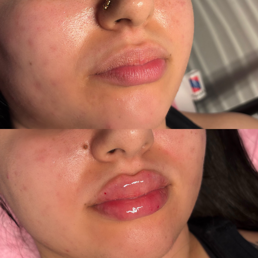 1.5ml Bestie Deal JULY SALE🩵 at Bodiedcosmeticss in Joliet, IL