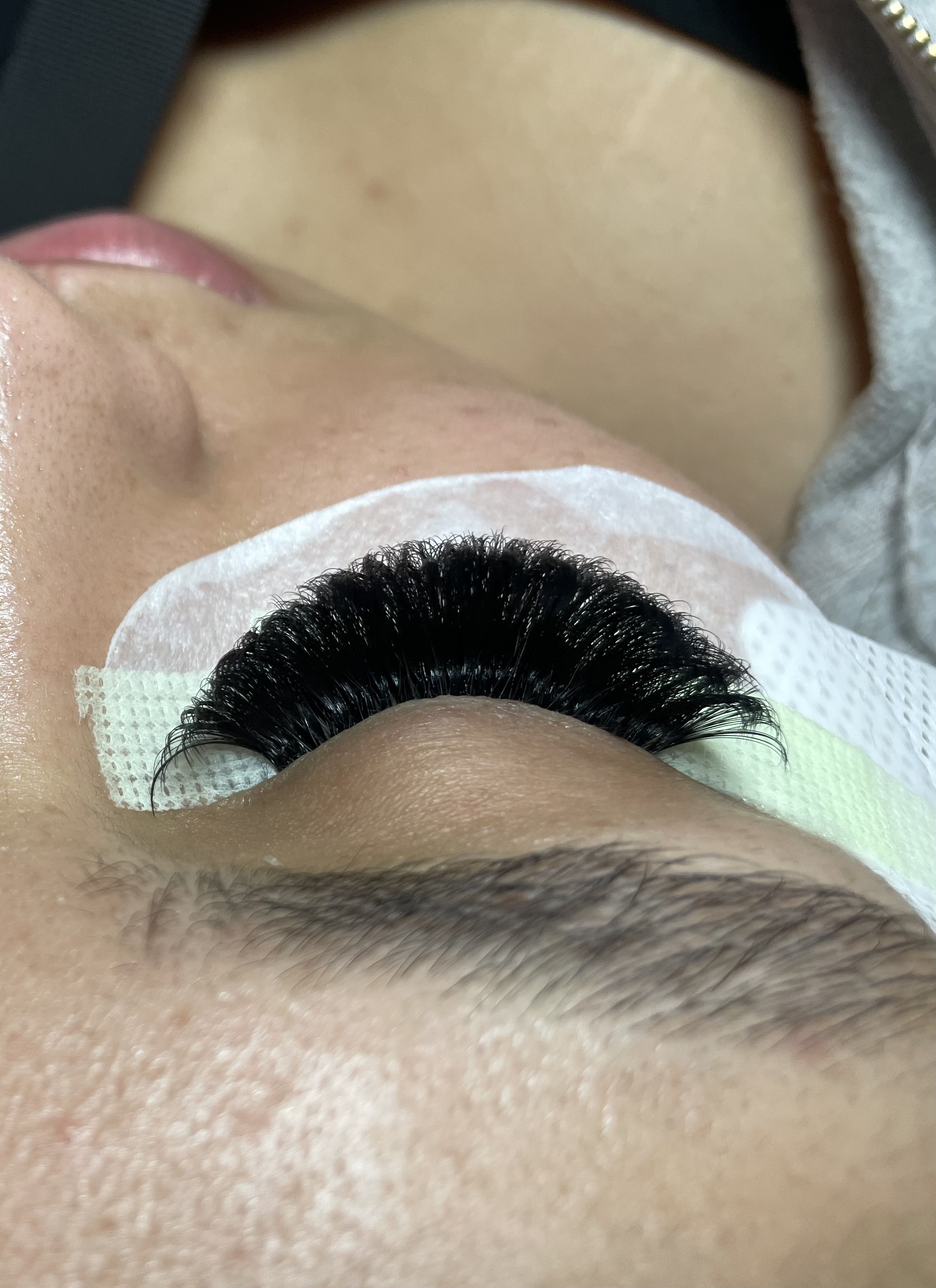 Mega Volume Fill