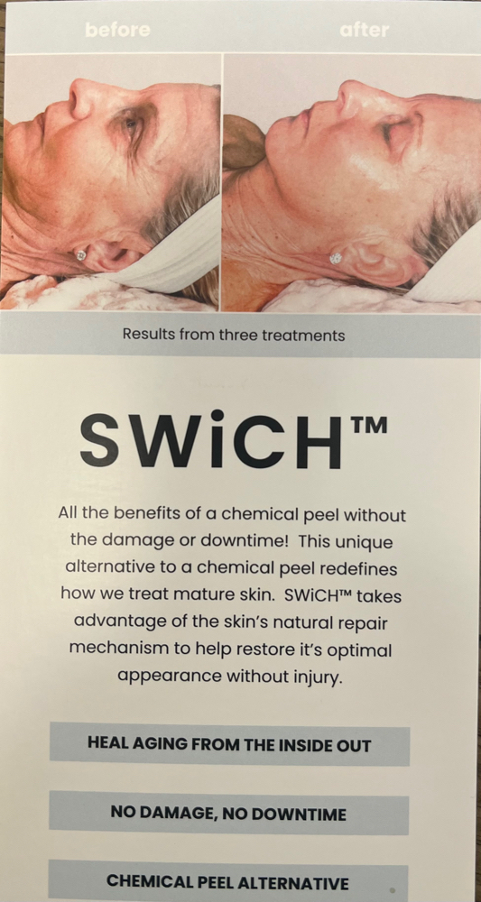 Swich Treatment