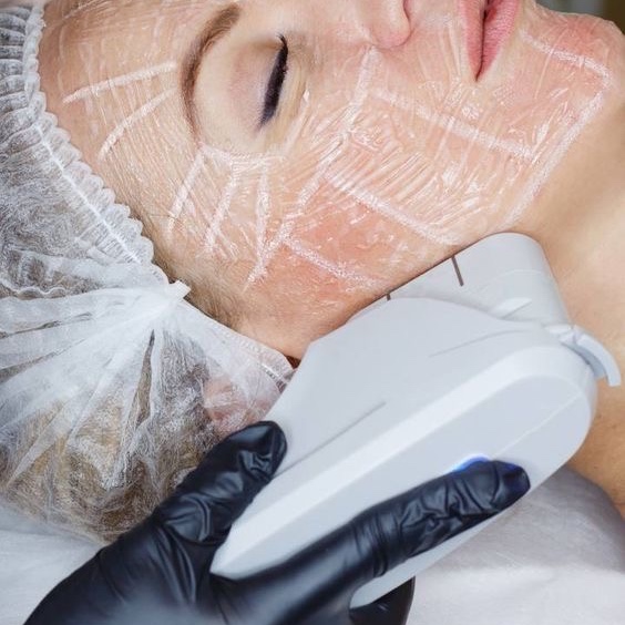 HIFU at Remake Beauty Studio San Juan in San Juan, TX