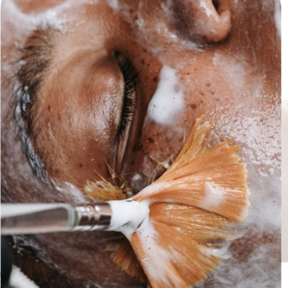 Microneedling (facial Not Included) at Arched in Studio City, CA