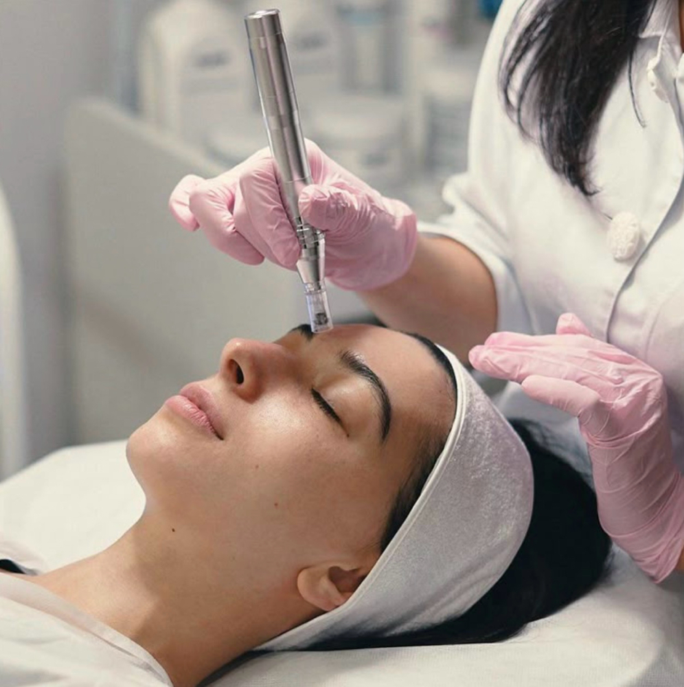 Microneedling at Pearl Skin Esthetics in Scottsdale, AZ