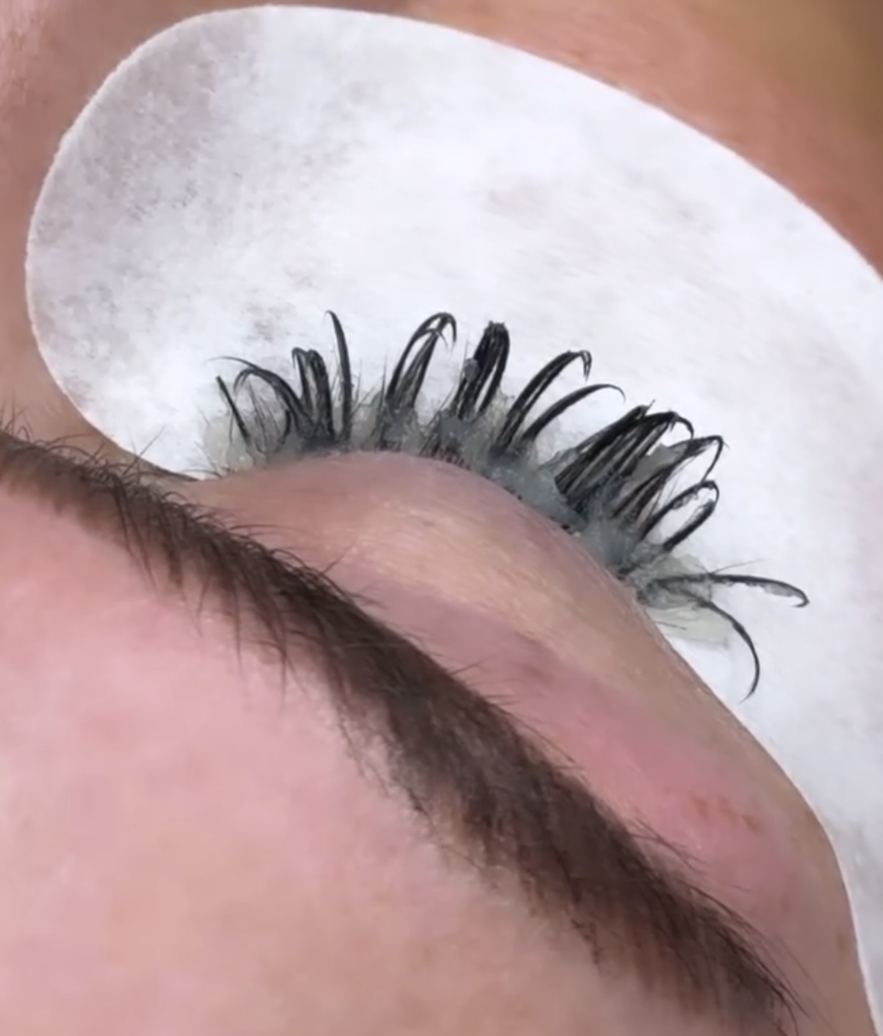 Lash Removal