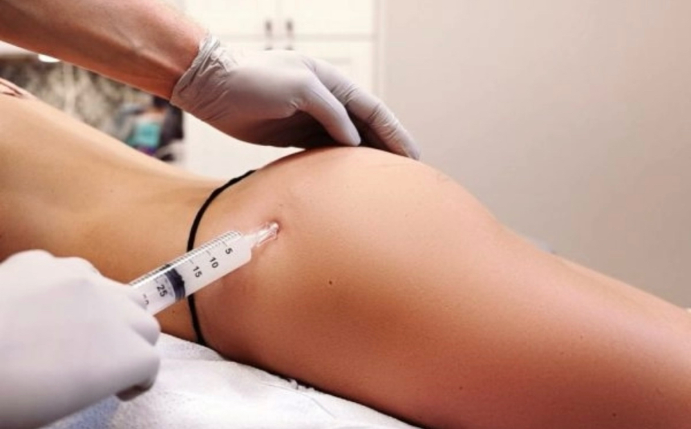 Non-Surgical Liquid BBL