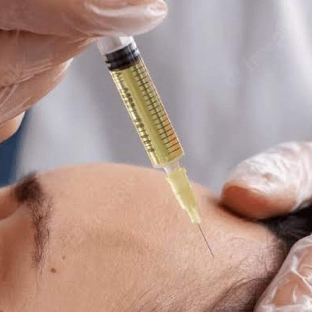 PRP/ PRF Therapy at Beauty by Nurse C in Pembroke Pines, FL